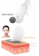 Гиалуроновые мезо-патчи с микроиглами